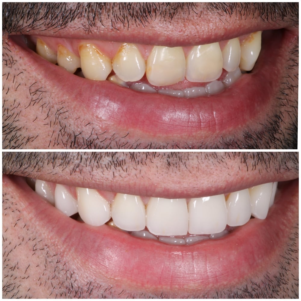 Dr. Pink Orthodontics - Orthodontist in New Paltz & Kerhonkson, NY