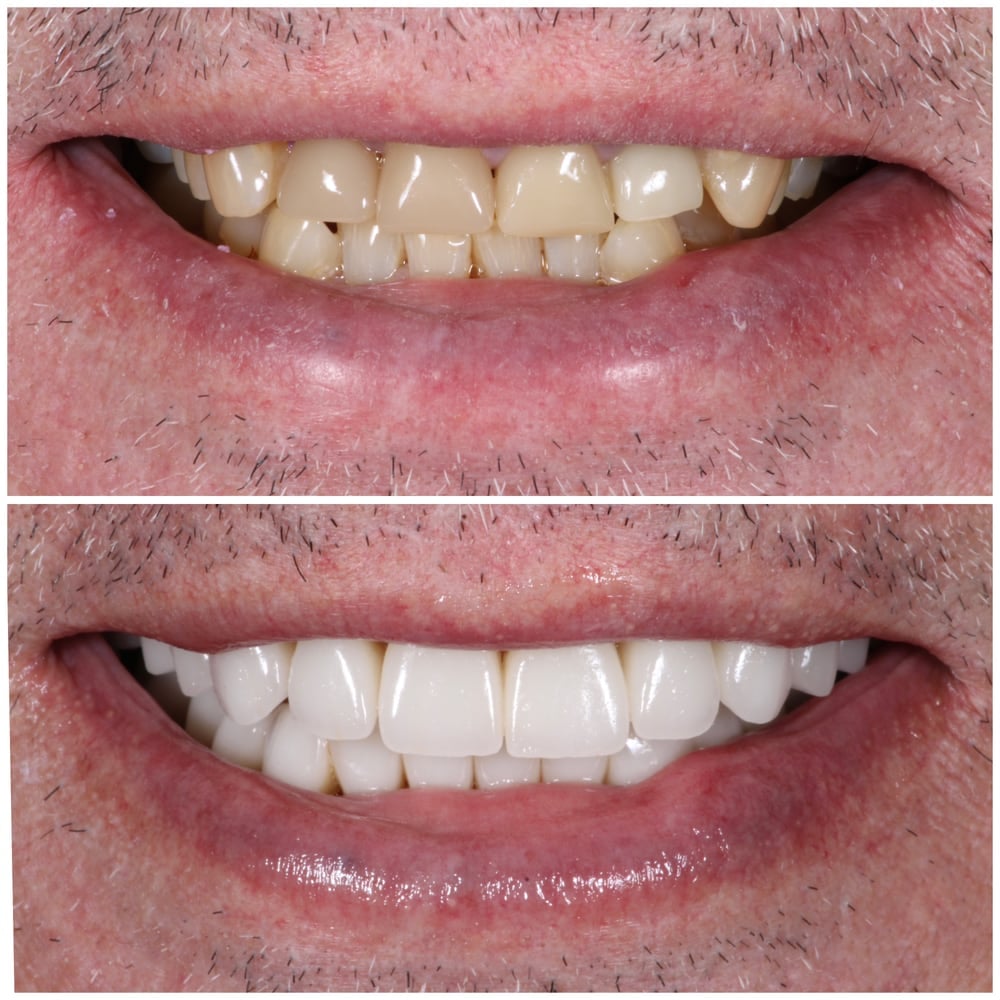 Dr. Pink Orthodontics - Orthodontist in New Paltz & Kerhonkson, NY