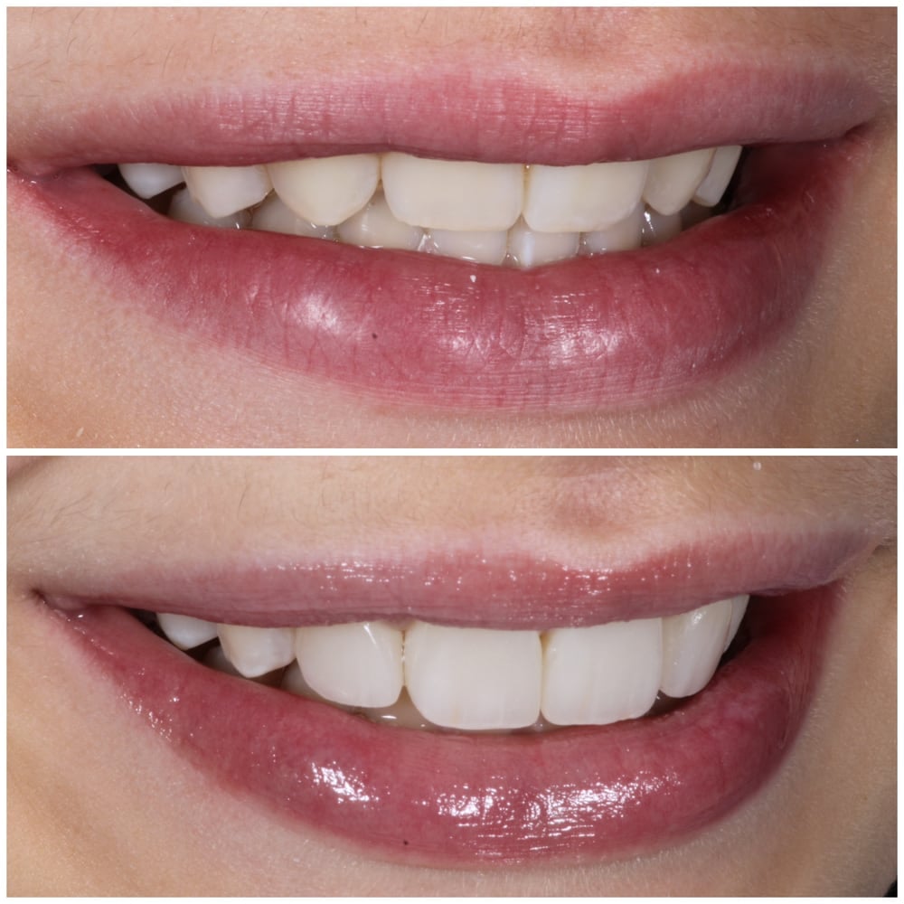 Dr. Pink Orthodontics - Orthodontist in New Paltz & Kerhonkson, NY
