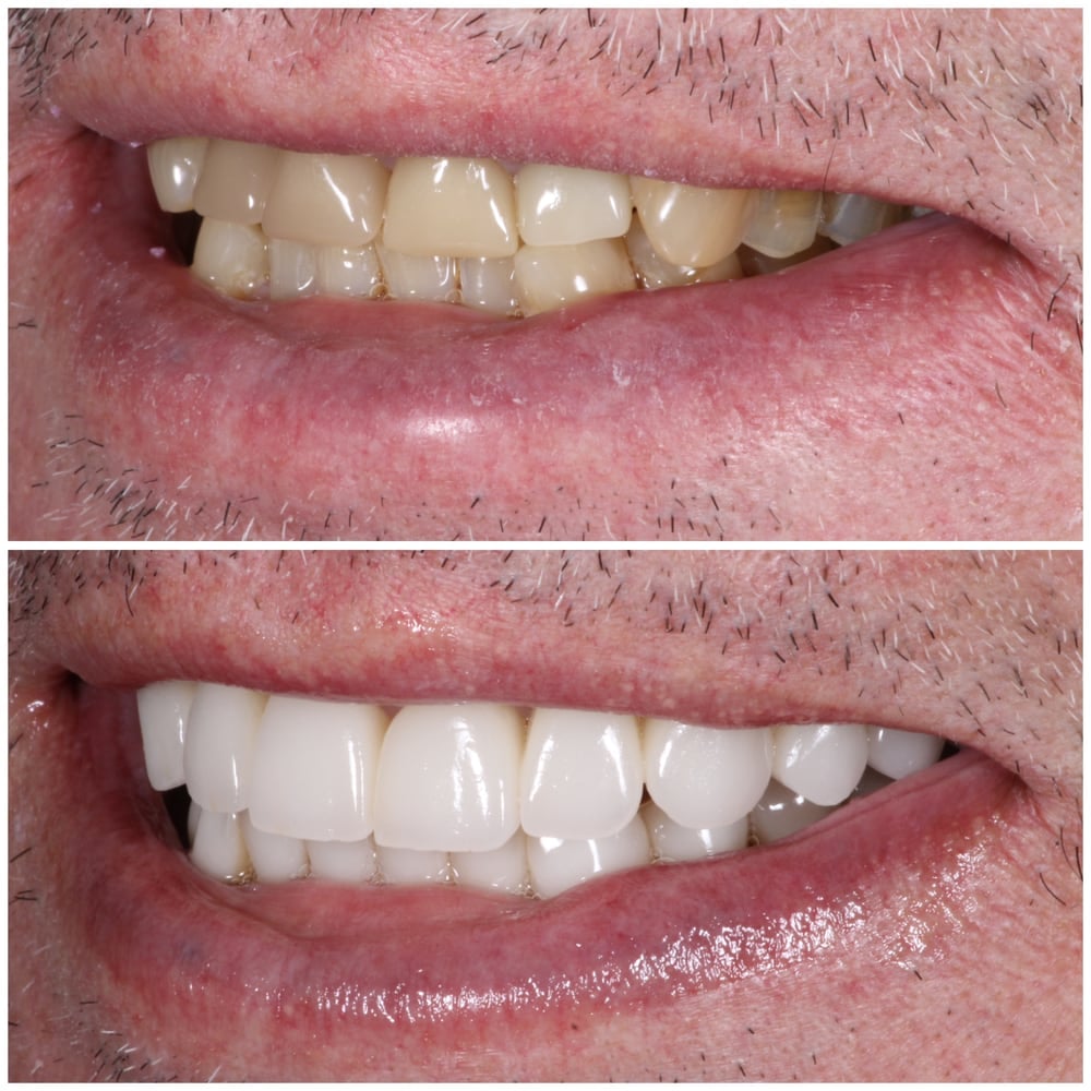 Dr. Pink Orthodontics - Orthodontist in New Paltz & Kerhonkson, NY