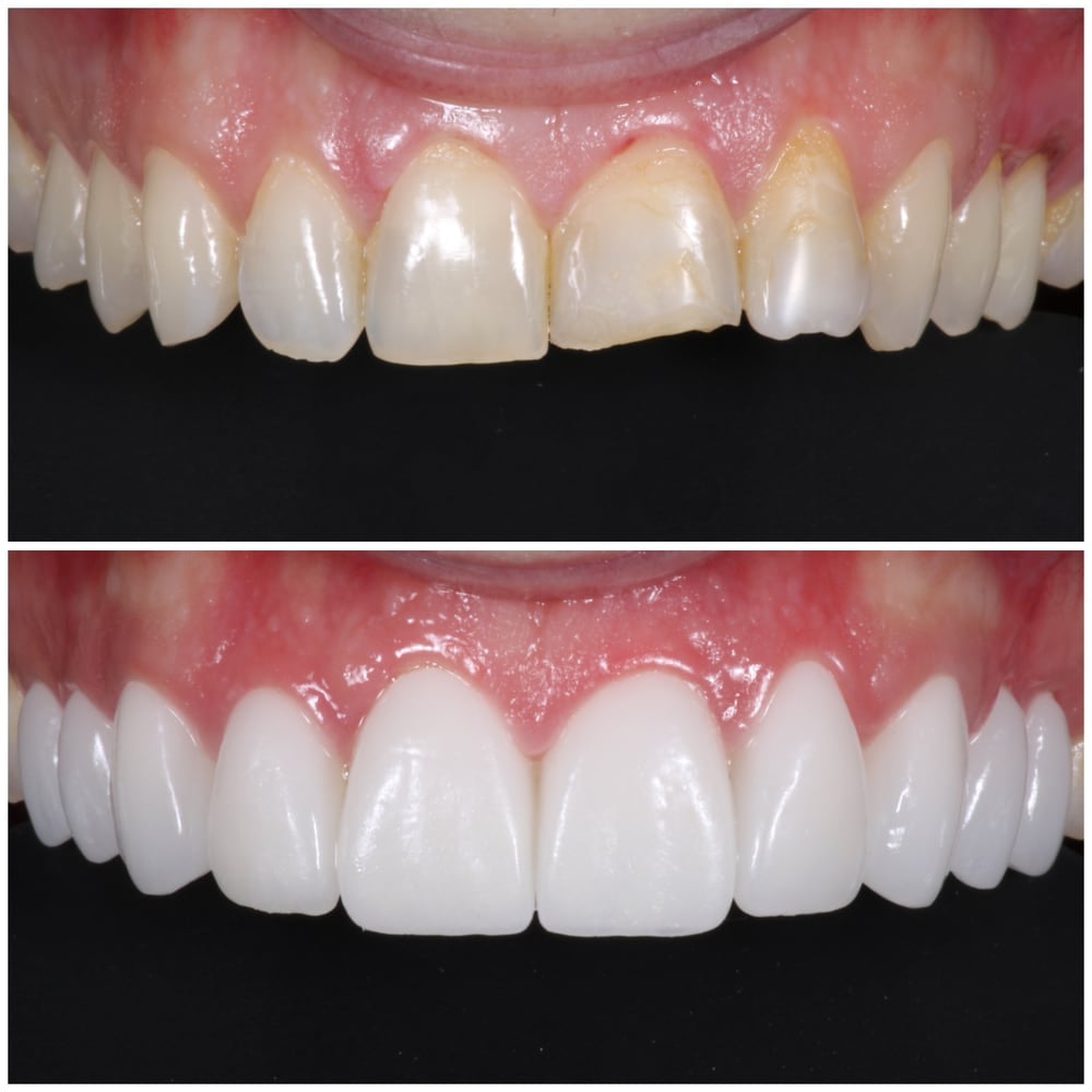 Dr. Pink Orthodontics - Orthodontist in New Paltz & Kerhonkson, NY
