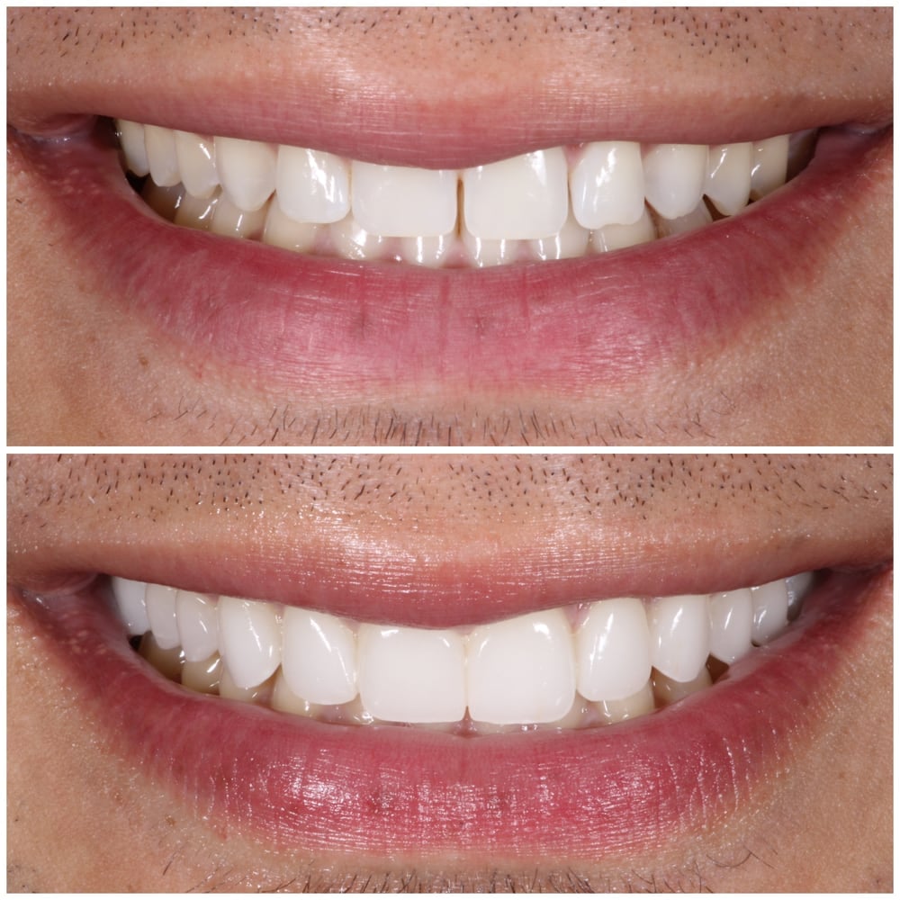 Dr. Pink Orthodontics - Orthodontist in New Paltz & Kerhonkson, NY