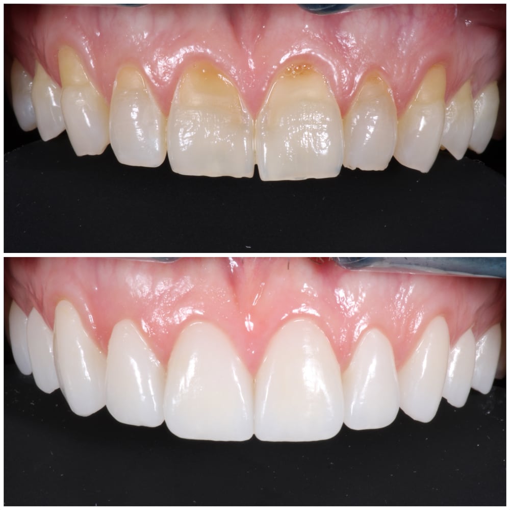 Dr. Pink Orthodontics - Orthodontist in New Paltz & Kerhonkson, NY