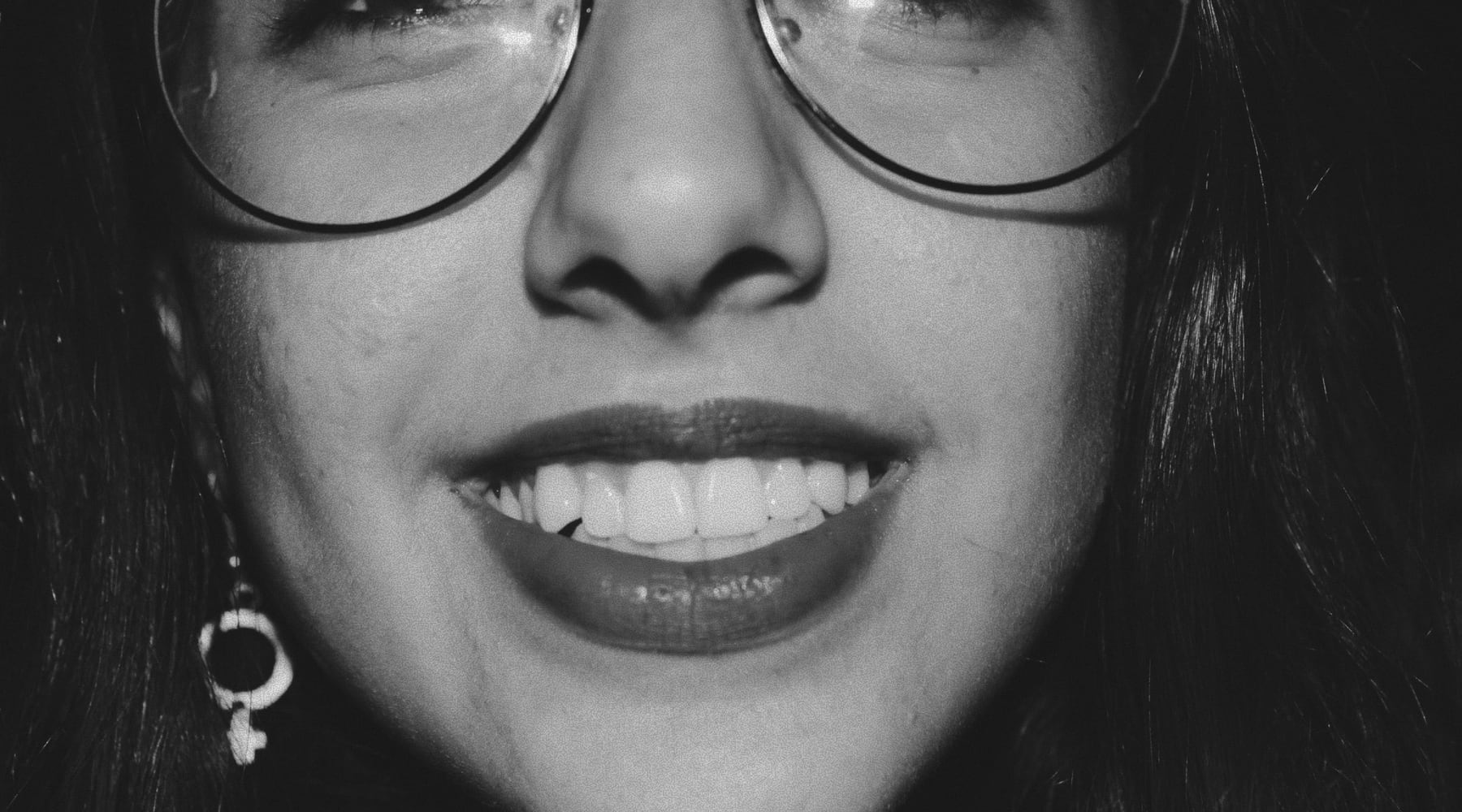 Close-up of a patient's smile